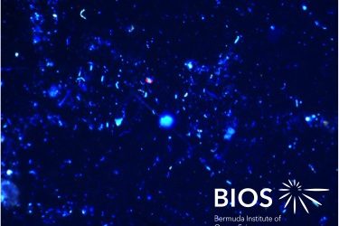 Plankton Profile: Oceanic bacterioplankton II