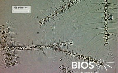 Plankton Profile: Chaetoceros