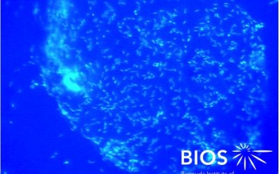 Plankton Profile: Oil Bacteria