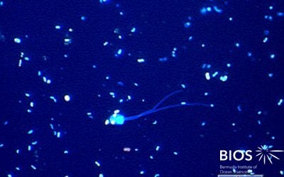 Plankton Profile: Photosynthetic Nanoflagellate II