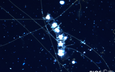 Plankton Profile: Chaetoceros II